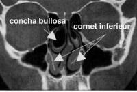 Institut de rhinoplastie à Genève en Suisse