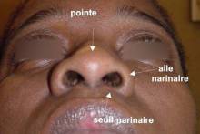 Institut de rhinoplastie à Genève en Suisse