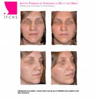 Dr Azan & Dr Susini -  Chirurgien à Bordeaux en Nouvelle-Aquitaine pour faire une septoplastie